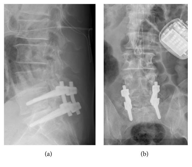 https://cdn.ncbi.nlm.nih.gov/pmc/blobs/281c/5554995/d98cae456224/BMRI2017-2964529.005.jpg