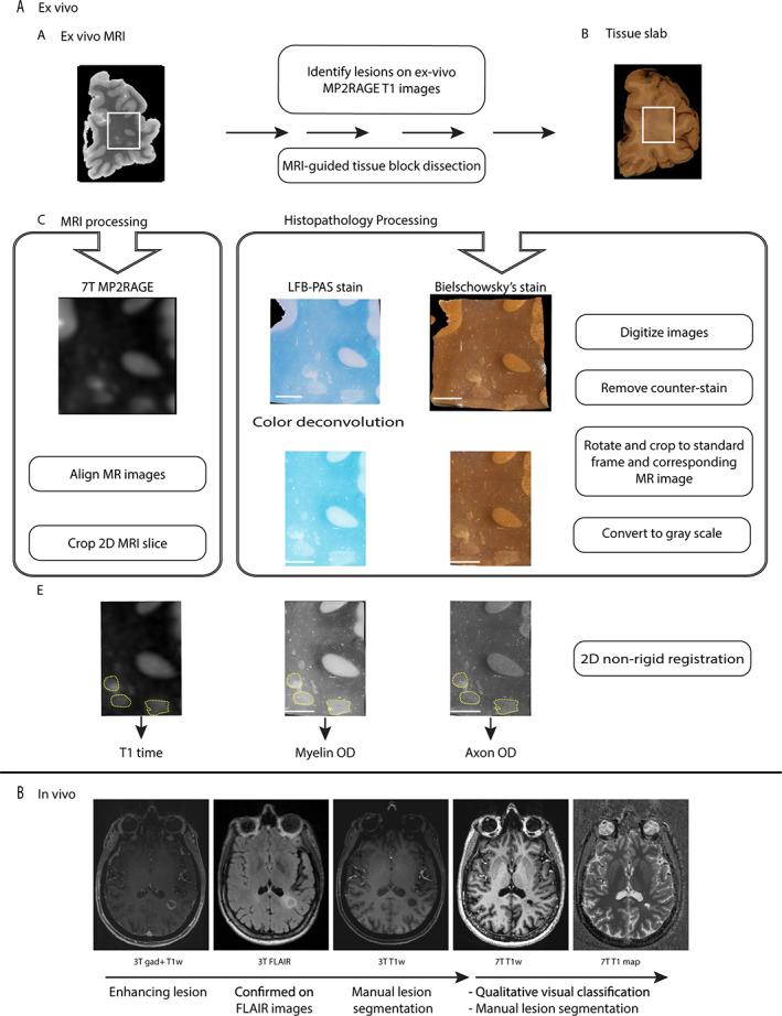 https://cdn.ncbi.nlm.nih.gov/pmc/blobs/281c/9291186/764696013116/ANA-90-612-g002.jpg