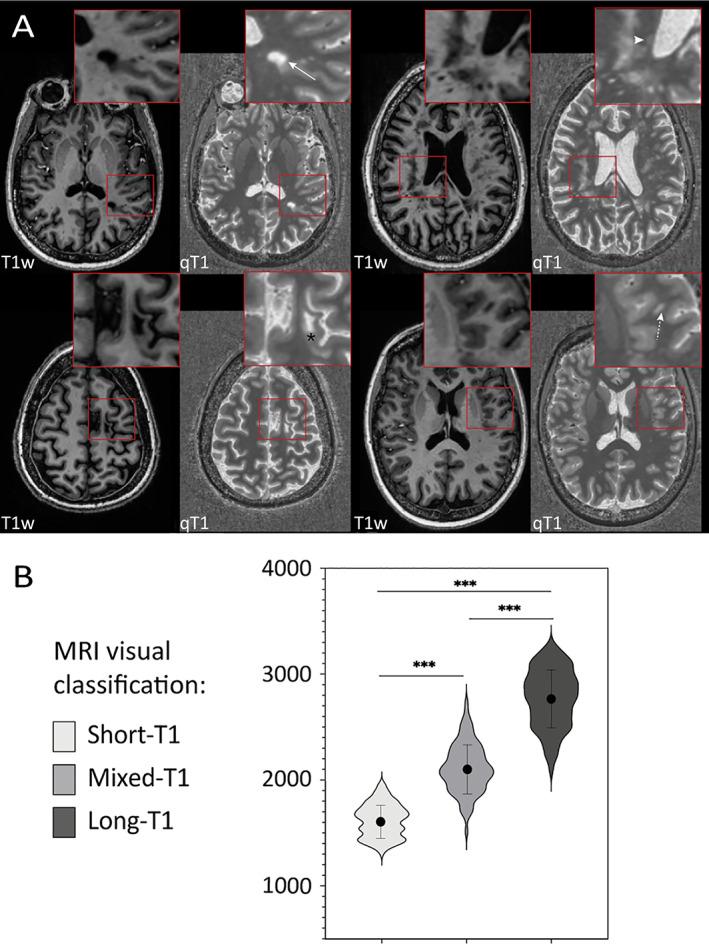 https://cdn.ncbi.nlm.nih.gov/pmc/blobs/281c/9291186/7f317e7aecc3/ANA-90-612-g004.jpg