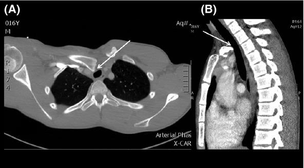 https://cdn.ncbi.nlm.nih.gov/pmc/blobs/281d/4175802/57ab0e69891a/jmrs0060-0067-f1.jpg