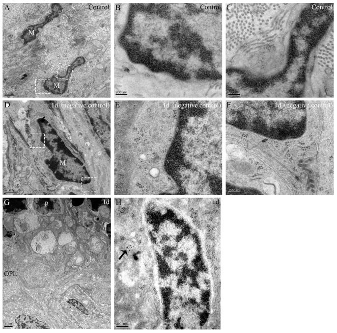 https://cdn.ncbi.nlm.nih.gov/pmc/blobs/2820/8100860/0563d4ff8ff0/mv-v27-206-f10.jpg