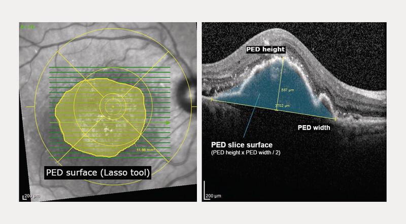 https://cdn.ncbi.nlm.nih.gov/pmc/blobs/2828/11038832/22773c7d44a3/10-1055-a-2248-9986-i0368kl01.jpg