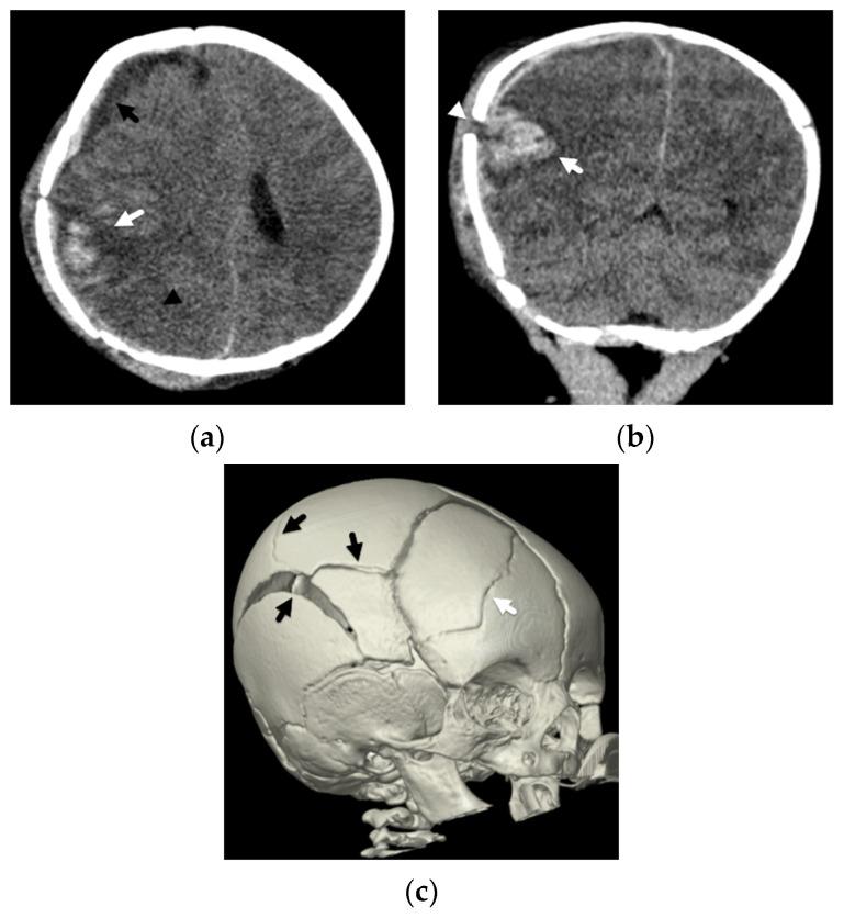 https://cdn.ncbi.nlm.nih.gov/pmc/blobs/2829/9029348/60167ff936fb/diagnostics-12-00955-g005.jpg
