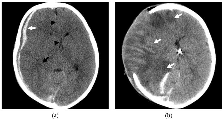 https://cdn.ncbi.nlm.nih.gov/pmc/blobs/2829/9029348/c2c4f75436b8/diagnostics-12-00955-g003.jpg