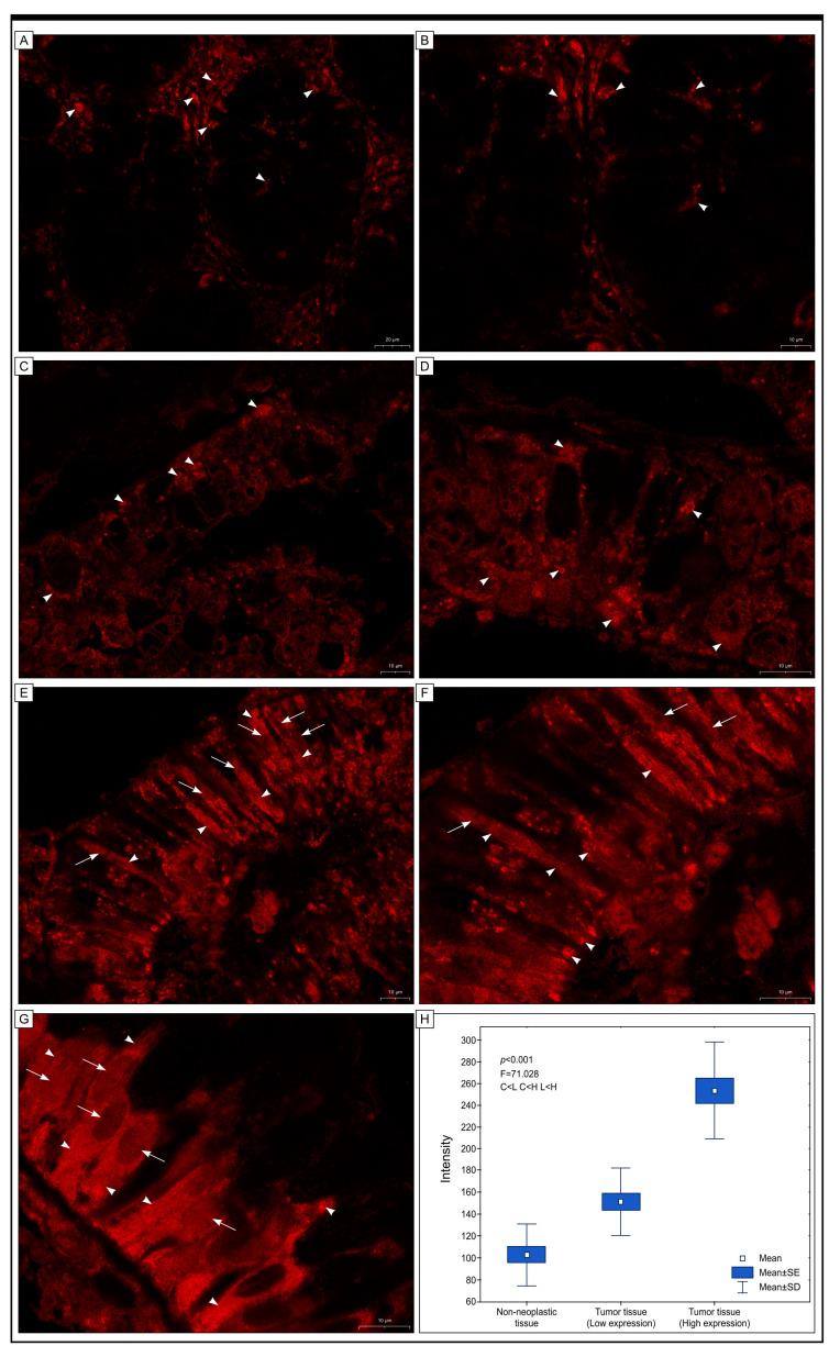 https://cdn.ncbi.nlm.nih.gov/pmc/blobs/282d/10138794/a21785d02062/ijms-24-07502-g005.jpg