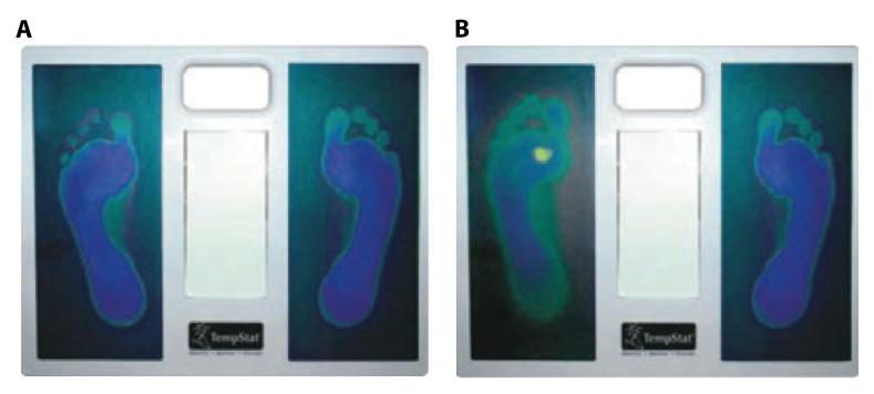 https://cdn.ncbi.nlm.nih.gov/pmc/blobs/282f/7463869/a8359a47c82b/wellcomeopenres-5-17701-g0000.jpg