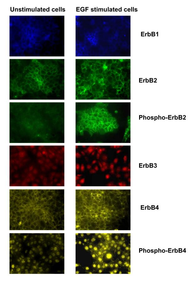 https://cdn.ncbi.nlm.nih.gov/pmc/blobs/2833/2841143/b21065e75b2a/1471-2407-10-84-7.jpg