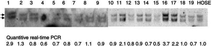 https://cdn.ncbi.nlm.nih.gov/pmc/blobs/2834/2364785/423225e91f3b/91-6602041f3.jpg