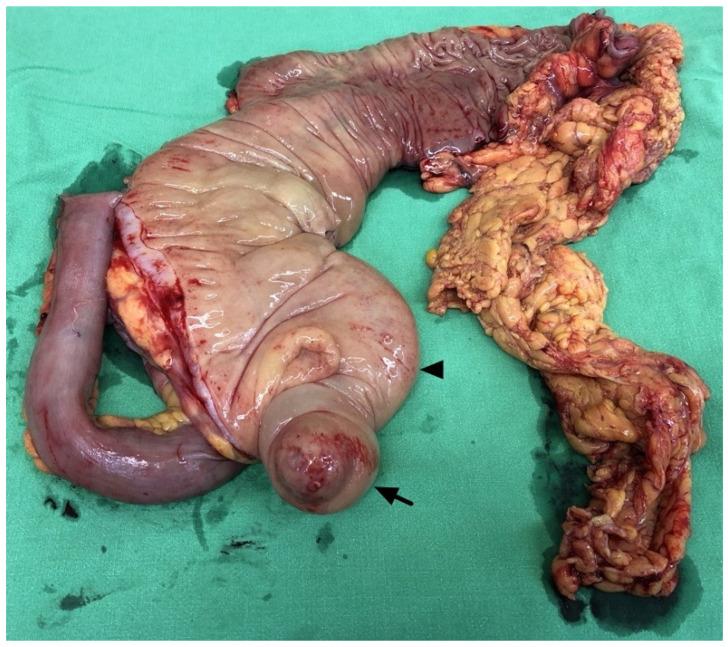 https://cdn.ncbi.nlm.nih.gov/pmc/blobs/2837/11431097/74e3218934f0/diagnostics-14-02040-g003.jpg