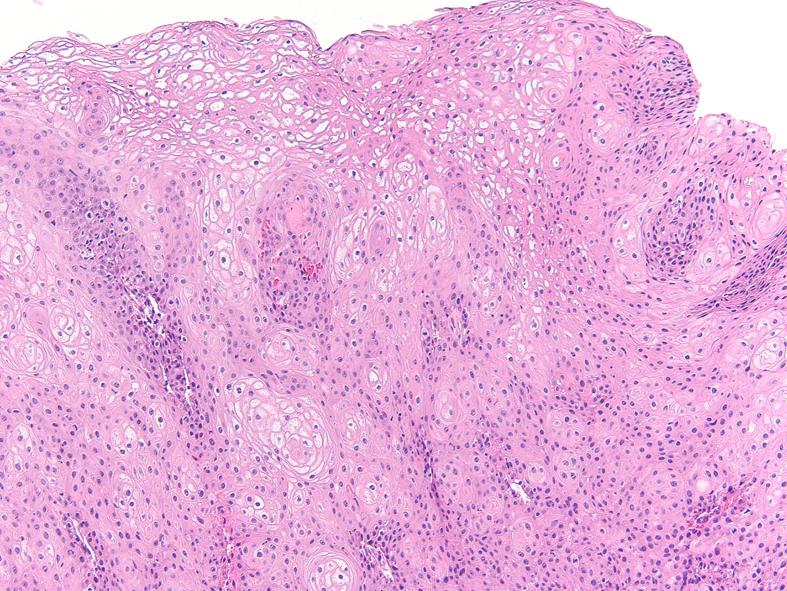 https://cdn.ncbi.nlm.nih.gov/pmc/blobs/283d/5722174/01e7baef80a8/gr2.jpg