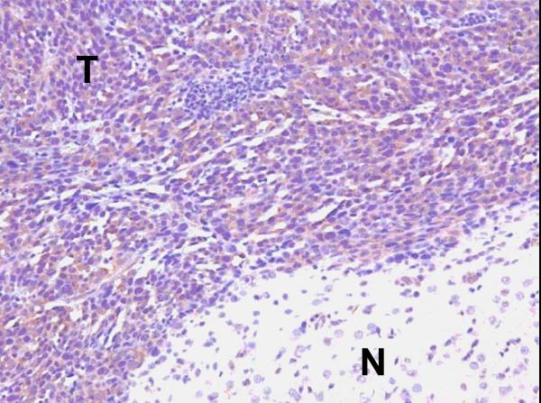 https://cdn.ncbi.nlm.nih.gov/pmc/blobs/2846/1802742/c72d0ac34875/1479-5876-5-10-1.jpg