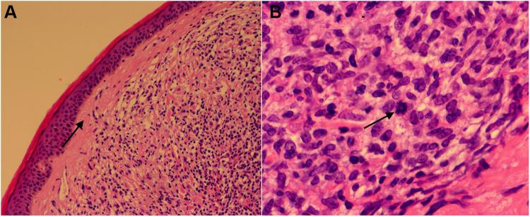 https://cdn.ncbi.nlm.nih.gov/pmc/blobs/284a/9271285/87fcf1cf6806/CCID-15-1265-g0002.jpg