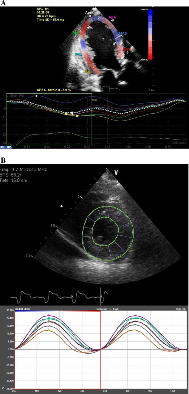 https://cdn.ncbi.nlm.nih.gov/pmc/blobs/2850/5402657/c6d9407e10d5/erp-3-R1-g001.jpg