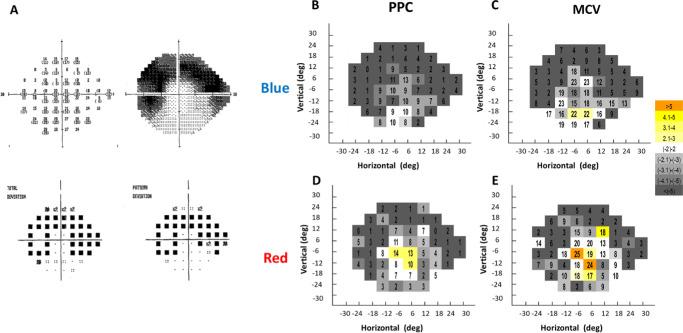 https://cdn.ncbi.nlm.nih.gov/pmc/blobs/2851/7422758/dbebaf768049/tvst-9-8-10-f006.jpg