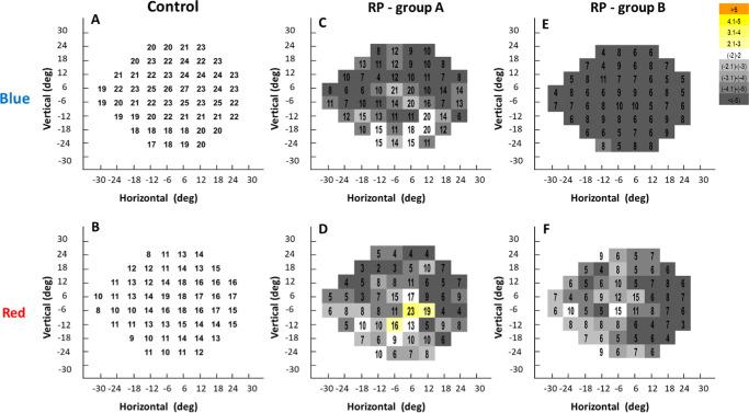 https://cdn.ncbi.nlm.nih.gov/pmc/blobs/2851/7422758/e4a03bd3ccf2/tvst-9-8-10-f002.jpg