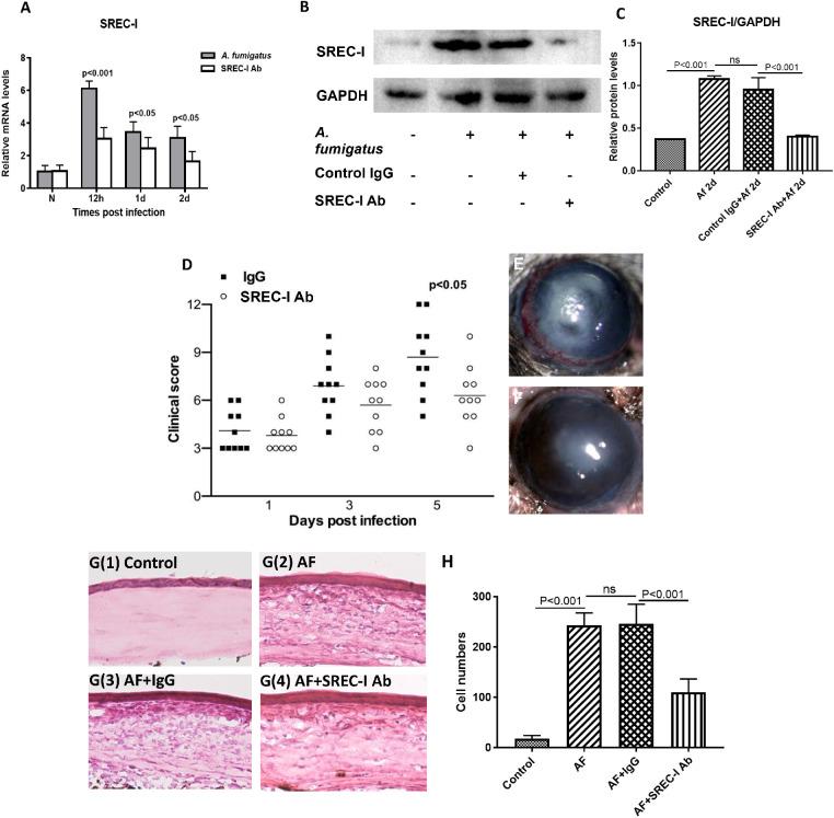 https://cdn.ncbi.nlm.nih.gov/pmc/blobs/285a/8267217/0bb850033ee0/iovs-62-9-12-f004.jpg