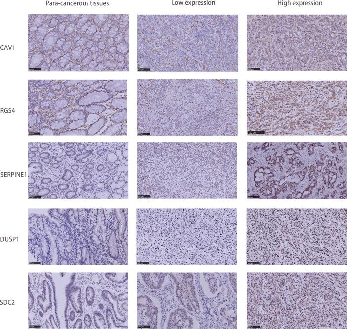 https://cdn.ncbi.nlm.nih.gov/pmc/blobs/285f/11769819/10a6dc8c2dfc/fonc-14-1499580-g010.jpg