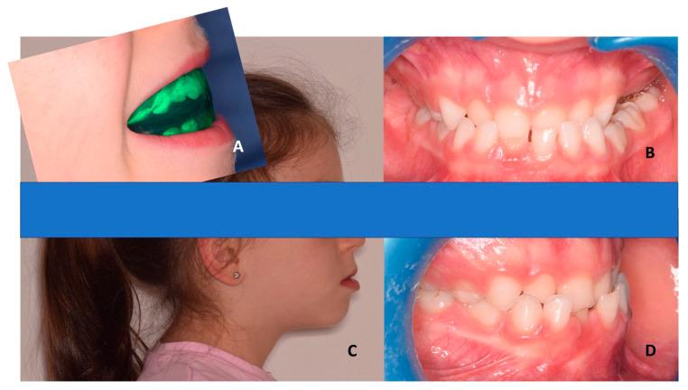 https://cdn.ncbi.nlm.nih.gov/pmc/blobs/2860/10670240/f4cfd84e336c/children-10-01821-g002.jpg