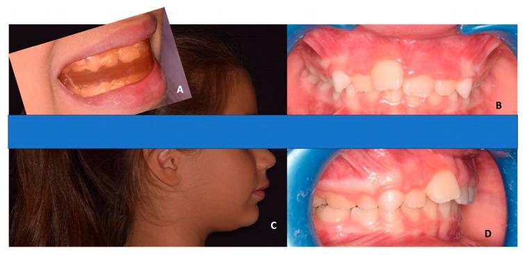 https://cdn.ncbi.nlm.nih.gov/pmc/blobs/2860/10670240/fa7141a964cd/children-10-01821-g003.jpg