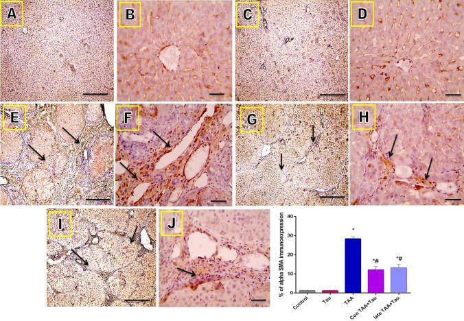 https://cdn.ncbi.nlm.nih.gov/pmc/blobs/2862/8192756/ec356d802306/41598_2021_91666_Fig6_HTML.jpg