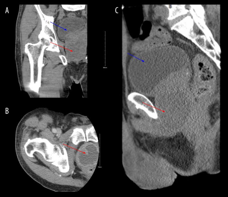 https://cdn.ncbi.nlm.nih.gov/pmc/blobs/2865/9257711/11624283a482/amjcaserep-23-e936704-g001.jpg