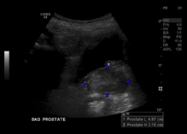 https://cdn.ncbi.nlm.nih.gov/pmc/blobs/2865/9257711/9323b28d042a/amjcaserep-23-e936704-g003.jpg