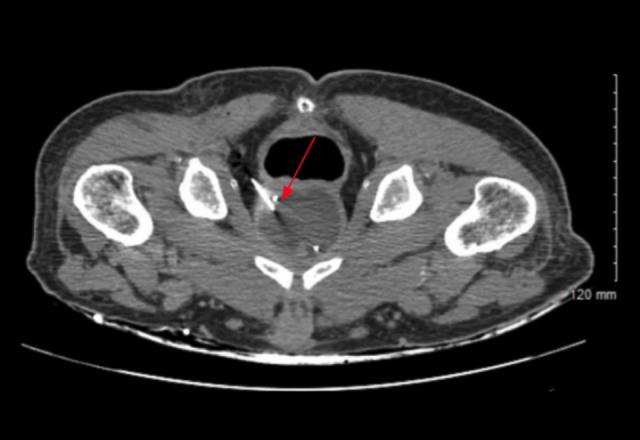 https://cdn.ncbi.nlm.nih.gov/pmc/blobs/2865/9257711/e5e085a5ead5/amjcaserep-23-e936704-g002.jpg