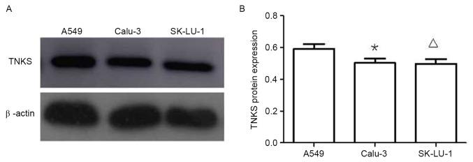 https://cdn.ncbi.nlm.nih.gov/pmc/blobs/2866/5958670/a8eadea533c6/ol-15-06-8973-g02.jpg