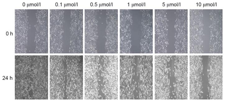 https://cdn.ncbi.nlm.nih.gov/pmc/blobs/2866/5958670/d47660f76491/ol-15-06-8973-g05.jpg