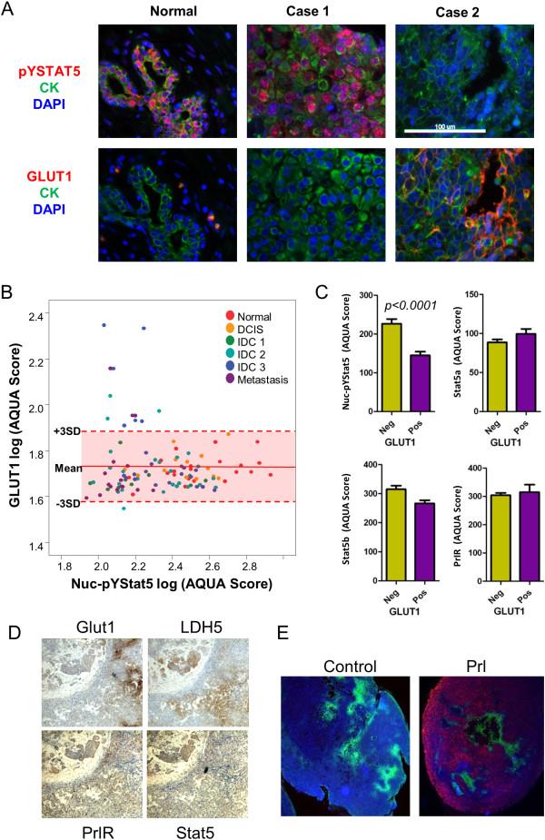 https://cdn.ncbi.nlm.nih.gov/pmc/blobs/2875/3978581/1d21f4fbadaa/bcr3467-6.jpg
