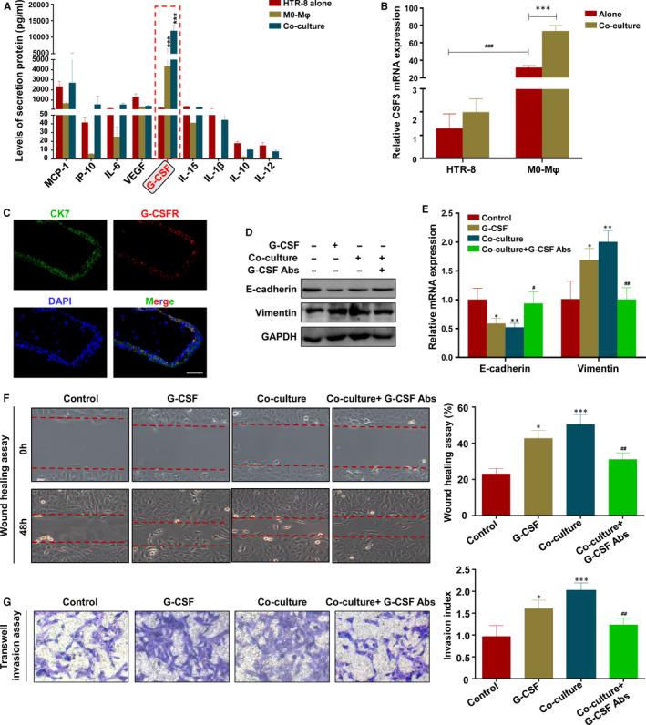 https://cdn.ncbi.nlm.nih.gov/pmc/blobs/287a/7882967/ad70061fbe51/JCMM-25-2136-g002.jpg