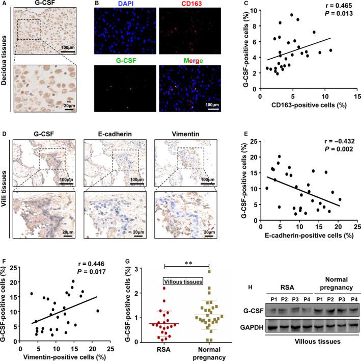 https://cdn.ncbi.nlm.nih.gov/pmc/blobs/287a/7882967/bb6af6fac163/JCMM-25-2136-g004.jpg