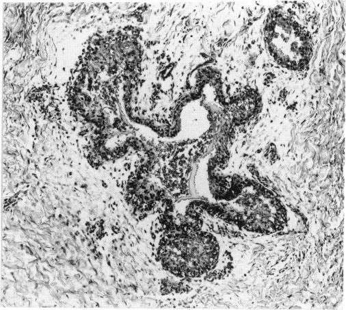 https://cdn.ncbi.nlm.nih.gov/pmc/blobs/287b/1519455/1be49427ee01/envhper00382-0127-a.jpg