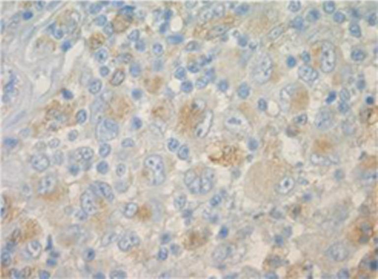 https://cdn.ncbi.nlm.nih.gov/pmc/blobs/2880/2441588/13bc1dad5191/277_2008_473_Fig1_HTML.jpg