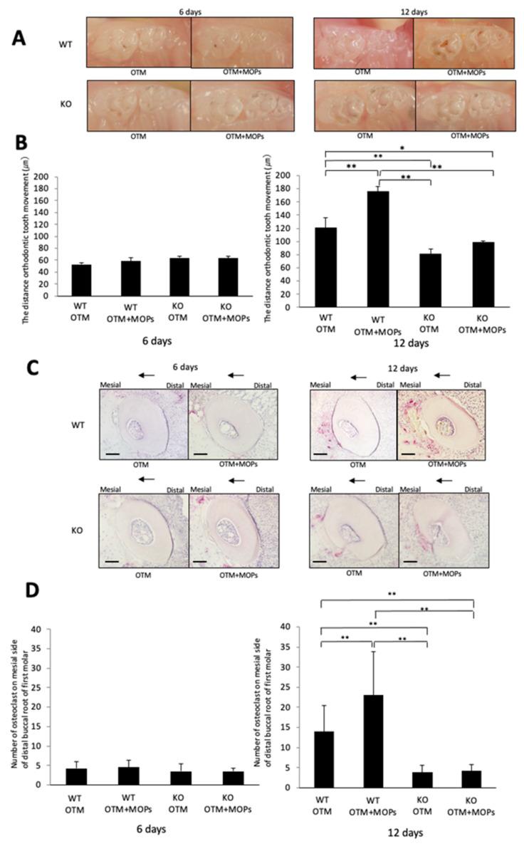 https://cdn.ncbi.nlm.nih.gov/pmc/blobs/2880/8955966/8908eb6cf5d8/ijms-23-02968-g004.jpg