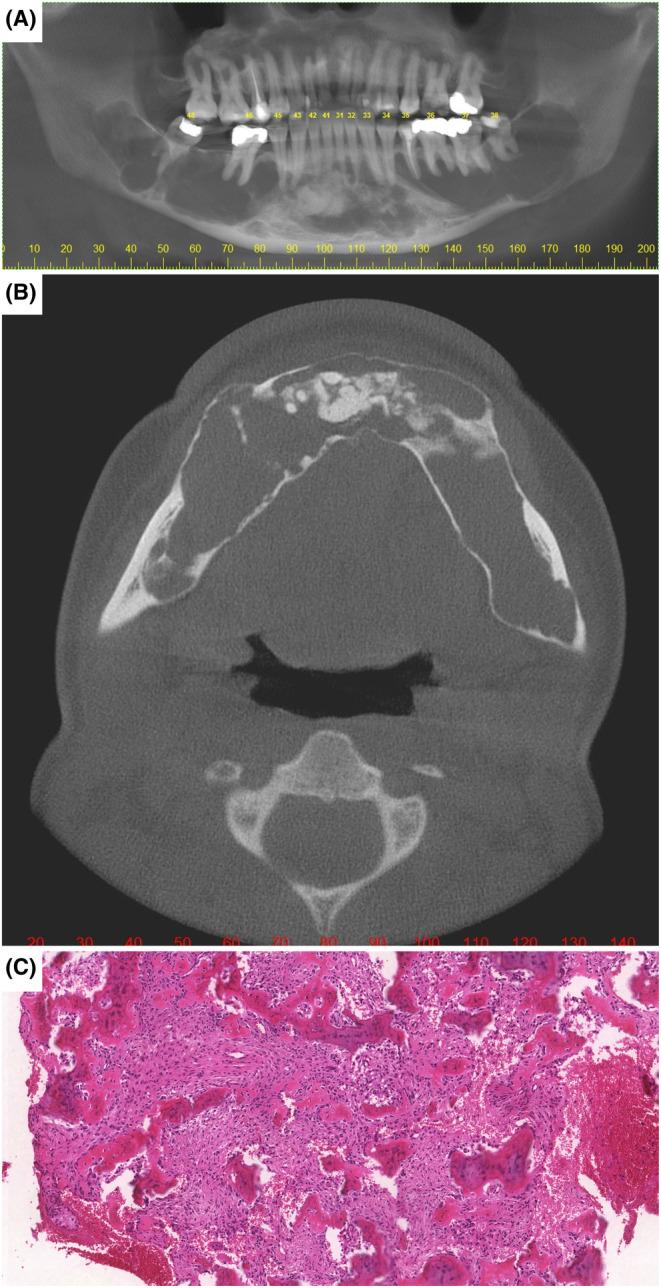 https://cdn.ncbi.nlm.nih.gov/pmc/blobs/2882/11300952/054b6b6caefb/CCR3-12-e9265-g002.jpg