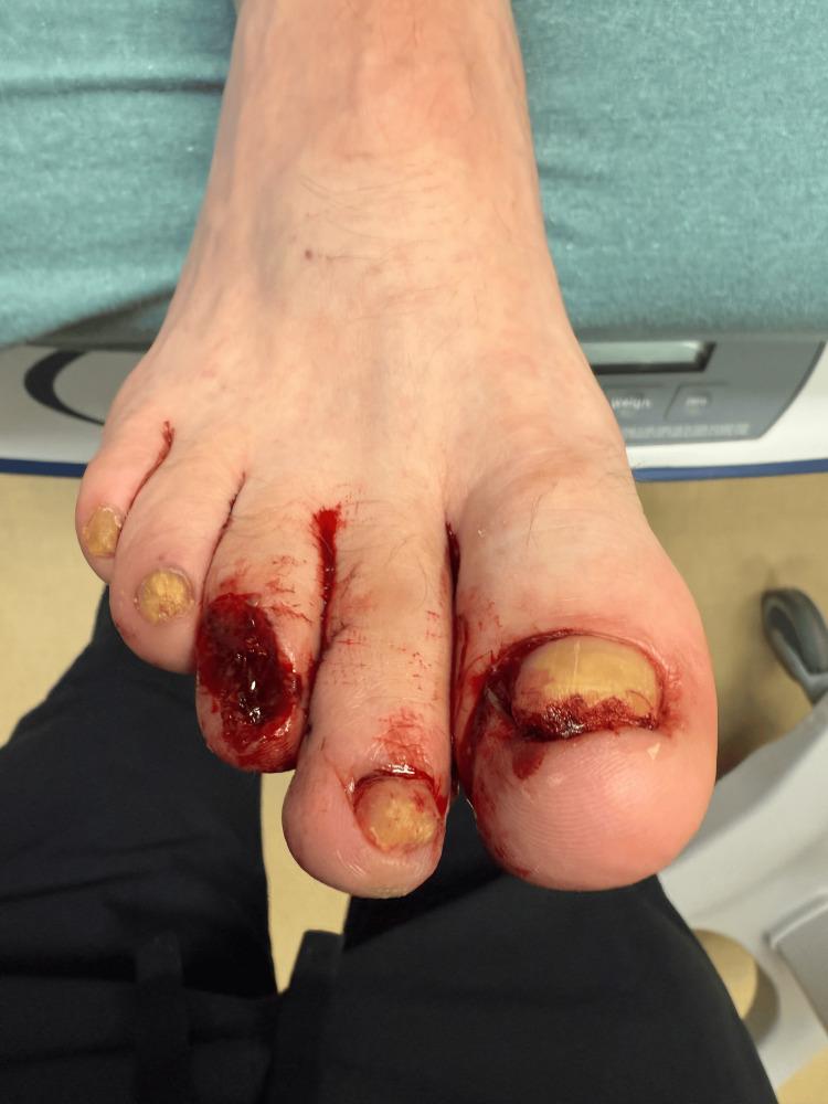 https://cdn.ncbi.nlm.nih.gov/pmc/blobs/2884/12374256/c62d98ca068f/cureus-0017-00000088655-i02.jpg