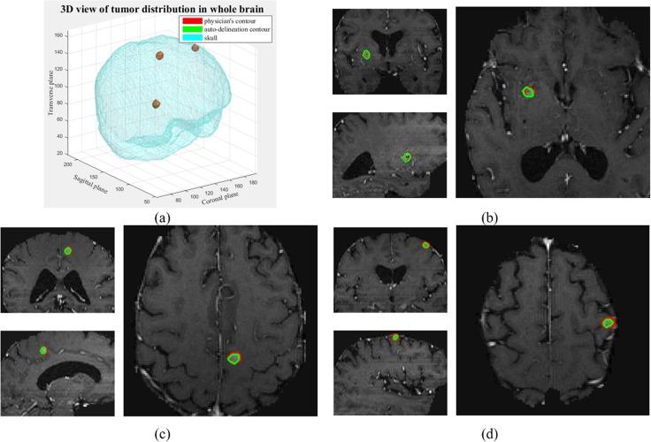 https://cdn.ncbi.nlm.nih.gov/pmc/blobs/2887/5630188/1bf2155f208b/pone.0185844.g007.jpg