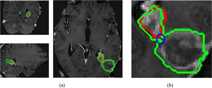 https://cdn.ncbi.nlm.nih.gov/pmc/blobs/2887/5630188/fe9dcded5e42/pone.0185844.g008.jpg