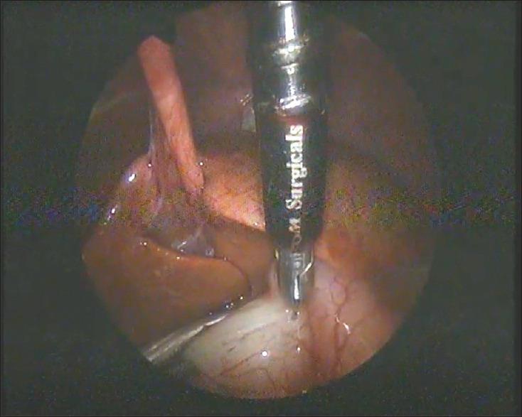 https://cdn.ncbi.nlm.nih.gov/pmc/blobs/2895/8109752/020e4318f56b/AJPS-18-14-g004.jpg