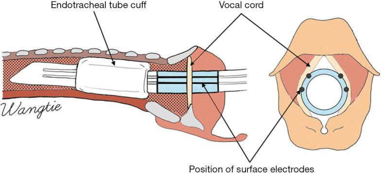 https://cdn.ncbi.nlm.nih.gov/pmc/blobs/289b/10493630/39f4abb03642/gs-12-08-1031-f1.jpg