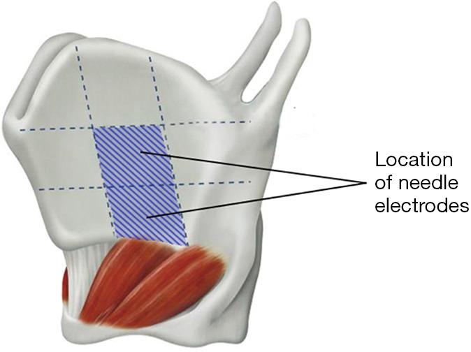 https://cdn.ncbi.nlm.nih.gov/pmc/blobs/289b/10493630/867f08f6df6b/gs-12-08-1031-f2.jpg