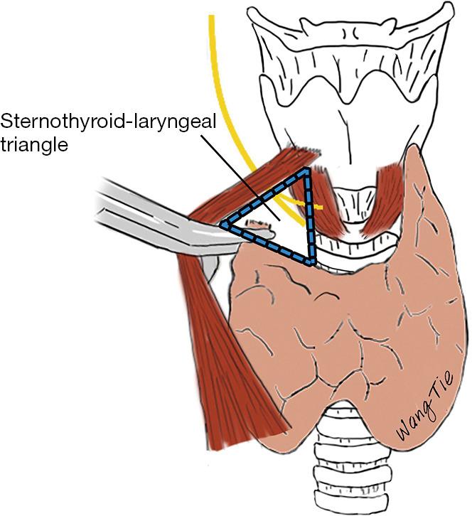 https://cdn.ncbi.nlm.nih.gov/pmc/blobs/289b/10493630/99fbe6b58b2a/gs-12-08-1031-f5.jpg