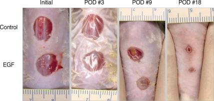 https://cdn.ncbi.nlm.nih.gov/pmc/blobs/28a3/2844601/212b98b445af/jkms-25-589-g002.jpg