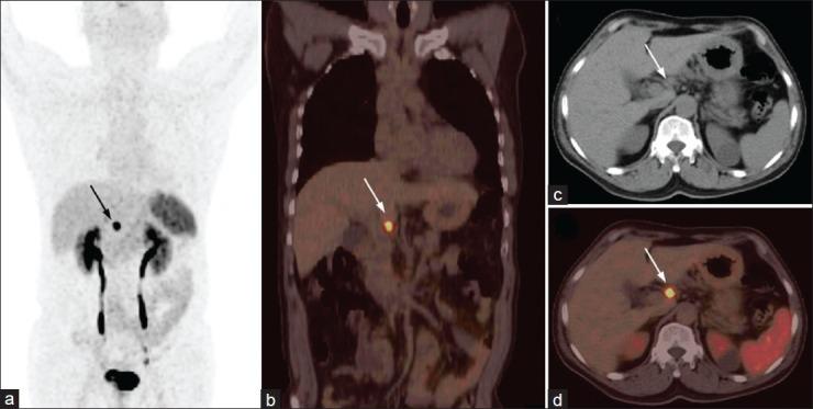 https://cdn.ncbi.nlm.nih.gov/pmc/blobs/28a5/3928745/1c59d61a9cba/IJNM-29-2-g004.jpg