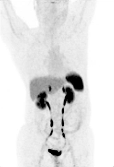 https://cdn.ncbi.nlm.nih.gov/pmc/blobs/28a5/3928745/54859de2096f/IJNM-29-2-g002.jpg