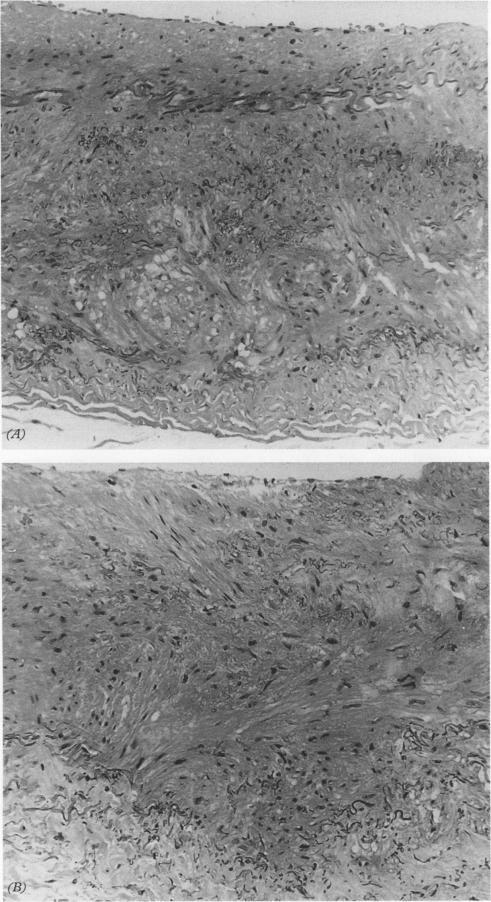 https://cdn.ncbi.nlm.nih.gov/pmc/blobs/28a5/502714/4fe1c74f15f4/jclinpath00232-0045-a.jpg