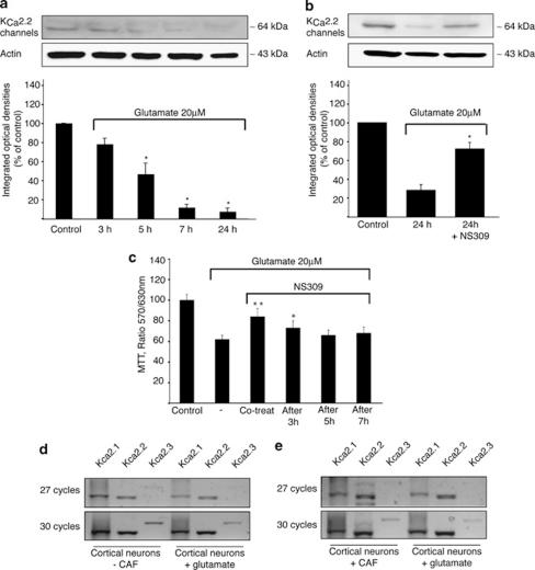 https://cdn.ncbi.nlm.nih.gov/pmc/blobs/28a7/3122061/9ce22c92485f/cddis201130f4.jpg