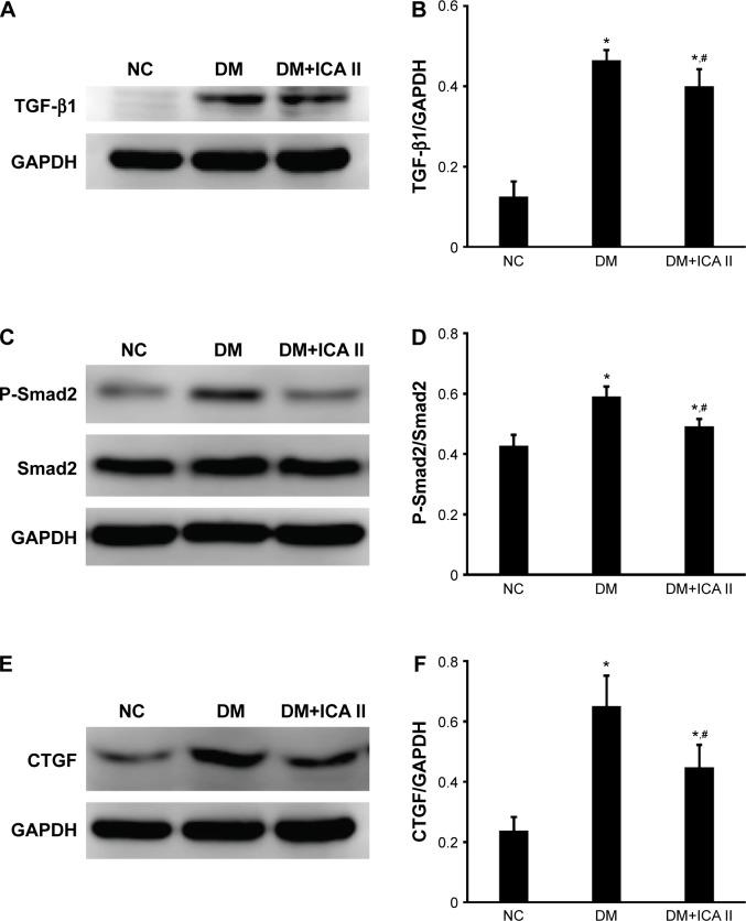 https://cdn.ncbi.nlm.nih.gov/pmc/blobs/28a8/4567177/8b23c962a315/dddt-9-5147Fig4.jpg