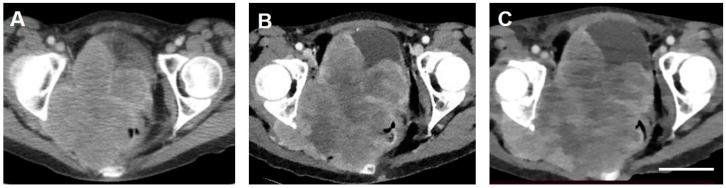 https://cdn.ncbi.nlm.nih.gov/pmc/blobs/28ab/8293172/ea0ae41d31ac/curroncol-28-00196-g003.jpg